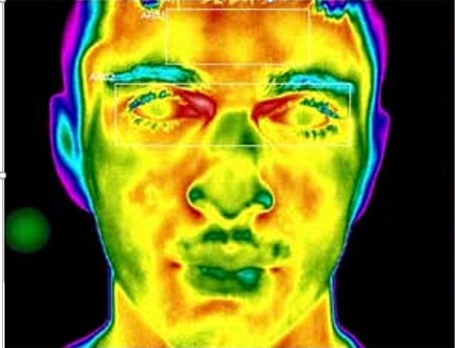 vidéo-surveillance